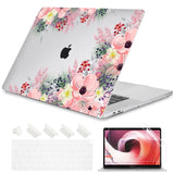 Laptop Case - Apple MacBook